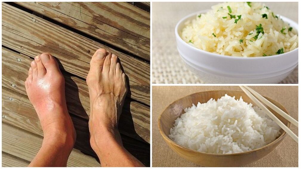 O dietă pe bază de orez este recomandată bolnavilor de gută. 